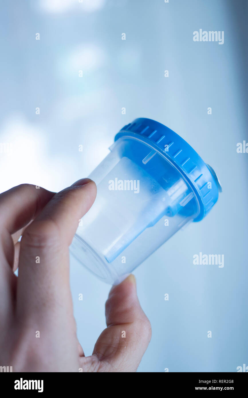 Medical urine test cup to hold patient dope testing anti drugs, sample Stock Photo Alamy