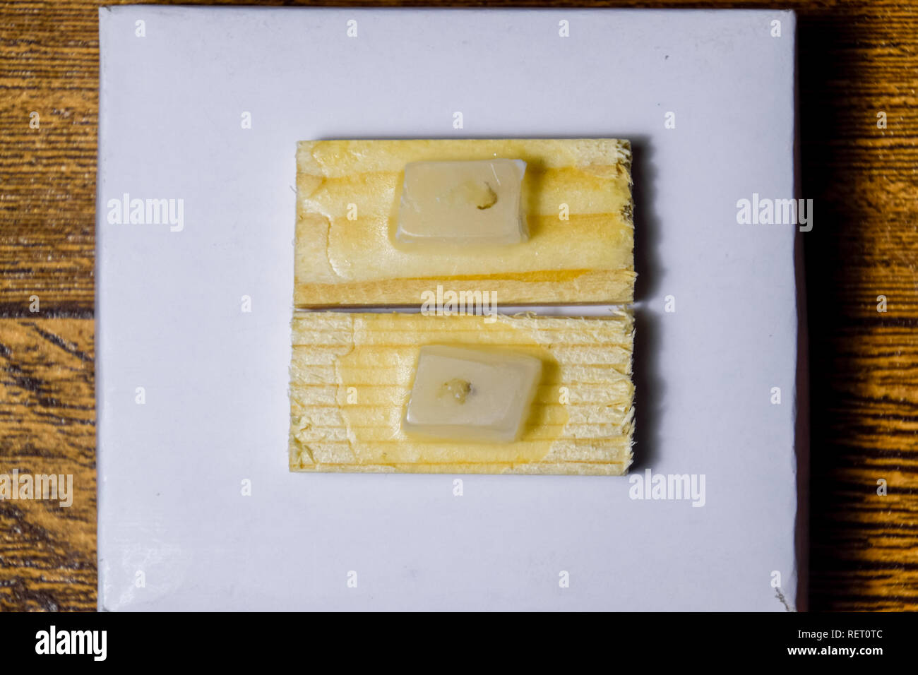 Paraffin blocks with cancer samples, samples for histological examination of the tumor. Pieces