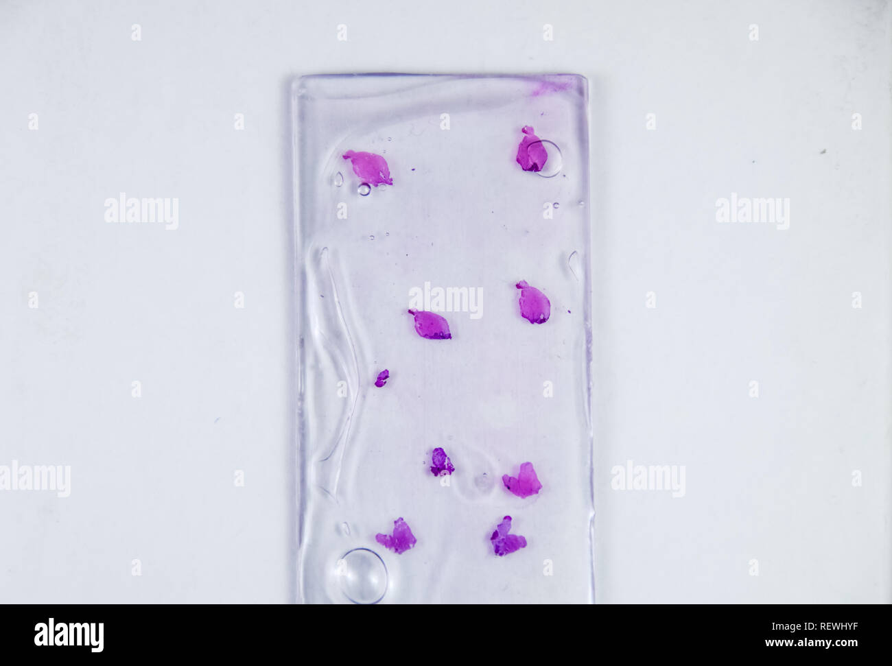 Slices of the tumor under glass. Histological examination of tumor