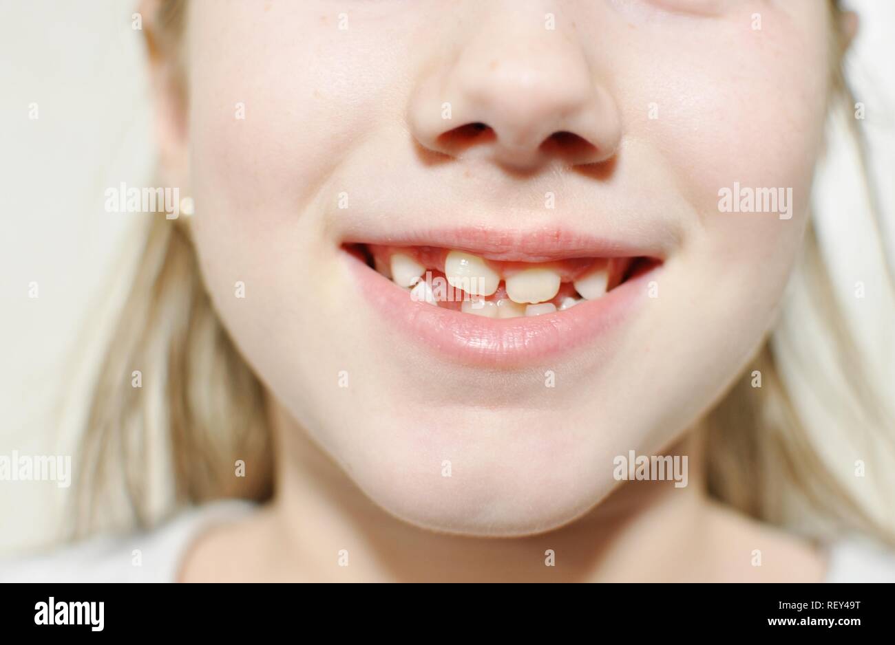 Close up of a child mouth with white stiff teeth. 8-9 years old girl. Concept of dental care Stock Photo