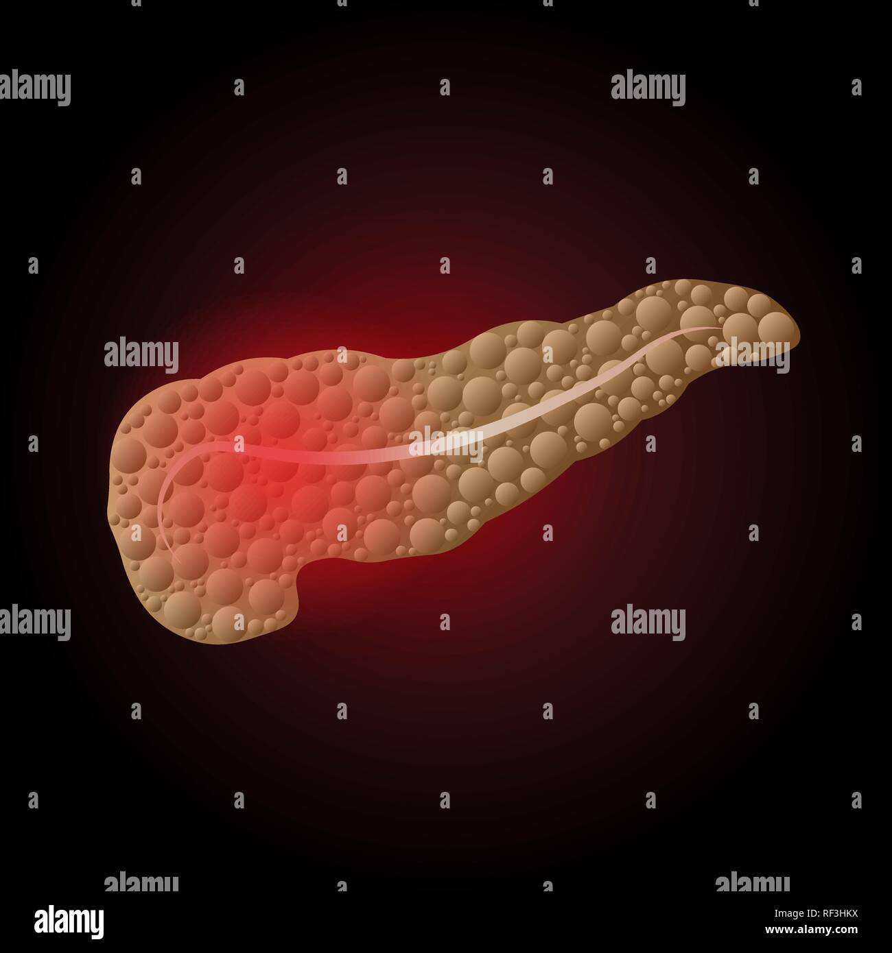 Medical illustration of pancreatic diseases with a point of pain ...