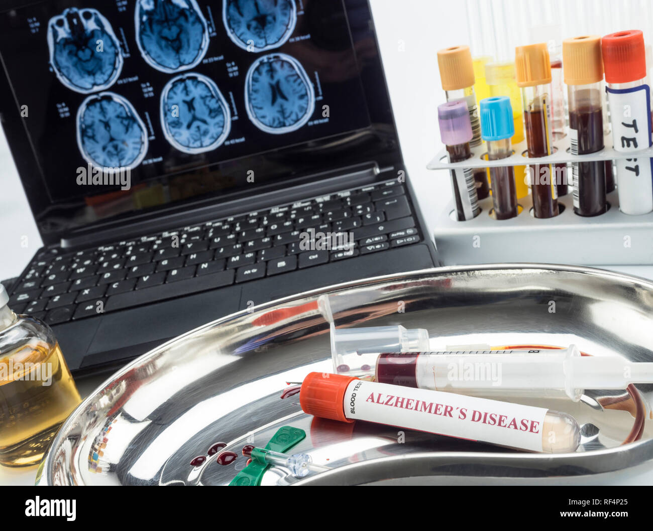 Blood sample to investigate remedy against Alzheimer disease, conceptual image Stock Photo