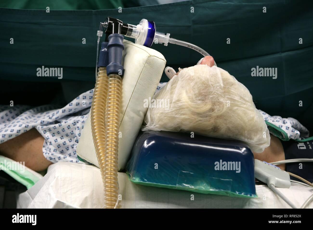 Patient during operation, artificial respiration, Germany Stock Photo
