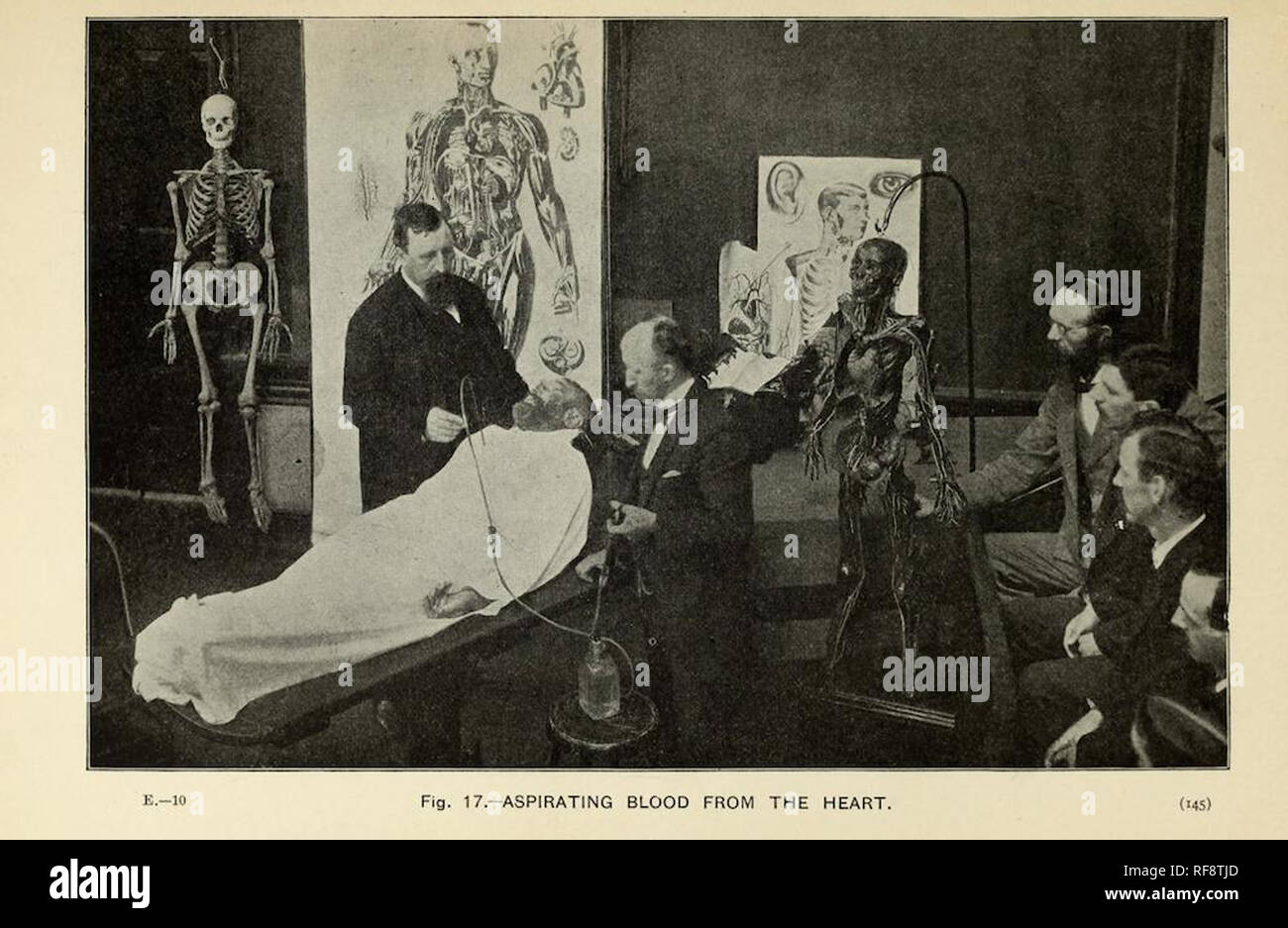 Vintage victorian photograph of medical scientists and doctors studying a cadaver Stock Photo