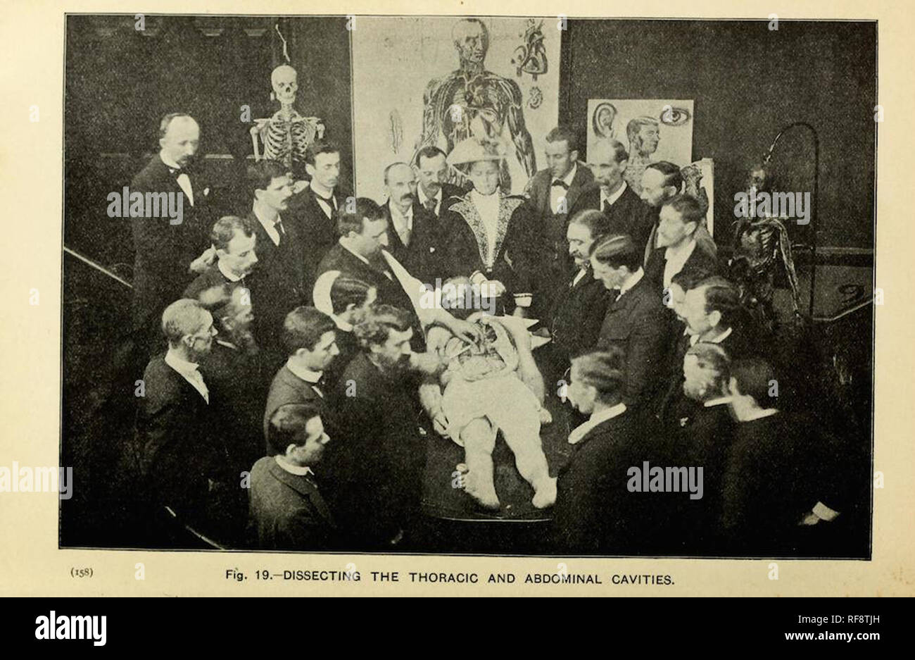 Vintage victorian photograph of medical scientists and doctors studying a cadaver Stock Photo