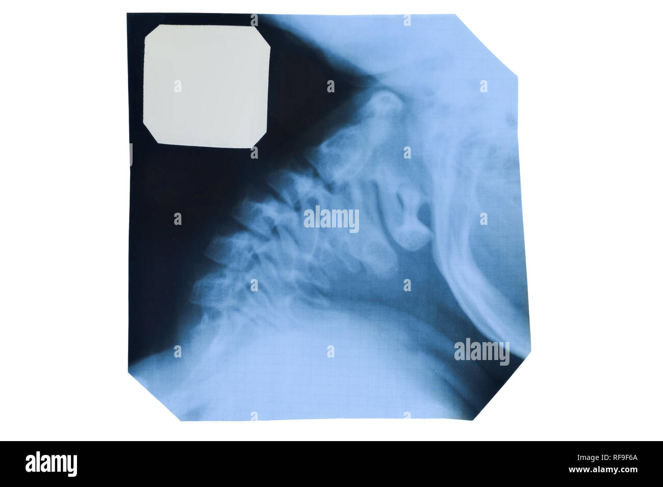 Lateral x ray cervical spine neck hi-res stock photography and images ...