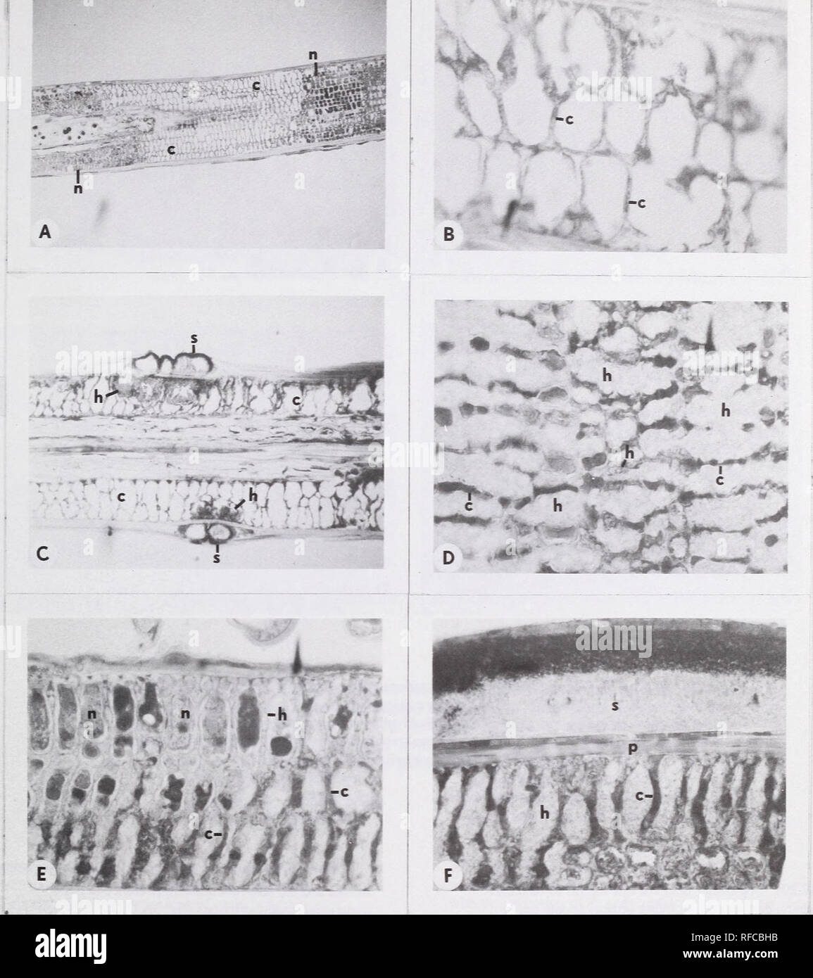 . Recent research on foliage diseases : conference proceedings : Carlisle, Pennsylvania, May 29-June 2, 1989. Leaves Diseases and pests United States Congresses. Figure 1.—A - C = Mycosphaerella dearnessii; D - F = Ploiodrema hedgcockii. All illustrations are from longitudinal sections. A) Section thru the mesophyll tissue. Note the noncollapsed and collapsed mesophyll cells, and the rather sharp separation of the two tissue types (X40); B) Col- lapsed mesophyll area exhibiting empty appearence due to lack of hyphae (X40); C) Stroma-bearing tissue exhibiting concentration of hyphae beneath str Stock Photo