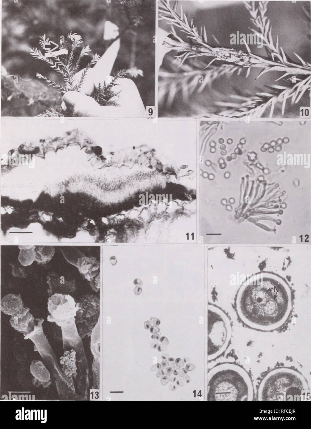 . Recent research on foliage diseases : conference proceedings : Carlisle, Pennsylvania, May 29-June 2, 1989. Leaves Diseases and pests United States Congresses. Figures 9-15.—Twig blight of Japanese cedar. 9. Dead twigs (arrow) resulting from inoculation of wounds. 10. A canker formed on a branch following inoculation. 11. A cross section of an acervulus of the twig blight fungus. 12. Conidia produced in chains from conidiogenous cells in an acervulus. 13. A scan- ning electron micrograph of conidia and conidiogenous cells. 14. Conidia with two nuclei, stained with HCl-Giemsa. 15. A transmiss Stock Photo