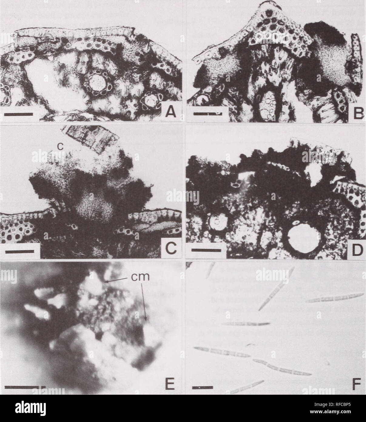 . Recent research on foliage diseases : conference proceedings : Carlisle, Pennsylvania, May 29-June 2, 1989. Leaves Diseases and pests United States Congresses. Figure 1.—Stromatal development and conidial production of Dothistroma septospora. A: Stromata developing under epidermis. B: Stromata appearing on the surface of the lesion by slitting epidermis. C: Stroma producing condidia (c). D: Stroma which has turned black and dried. E: Conidial masses (cm) produced on a stroma. F: Conidia. (Scales: A, B, C, D, E = 100 (im, F = 10 (im) As shown in table 1, conidia were first detected on stromat Stock Photo