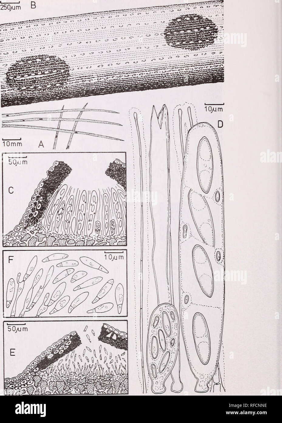 . Recent research on conifer needle diseases : conference proceedings, October 14-18, 1984, Gulfport, Mississippi. Conifers Diseases and pests Congresses. Ploioderma hedgcockii 104. Please note that these images are extracted from scanned page images that may have been digitally enhanced for readability - coloration and appearance of these illustrations may not perfectly resemble the original work.. Peterson, Glenn W; International Union of Forestry Research Organizations. Working Party on Needle Diseases. Washington, D. C. : U. S. Dept. of Agriculture, Forest Service Stock Photo