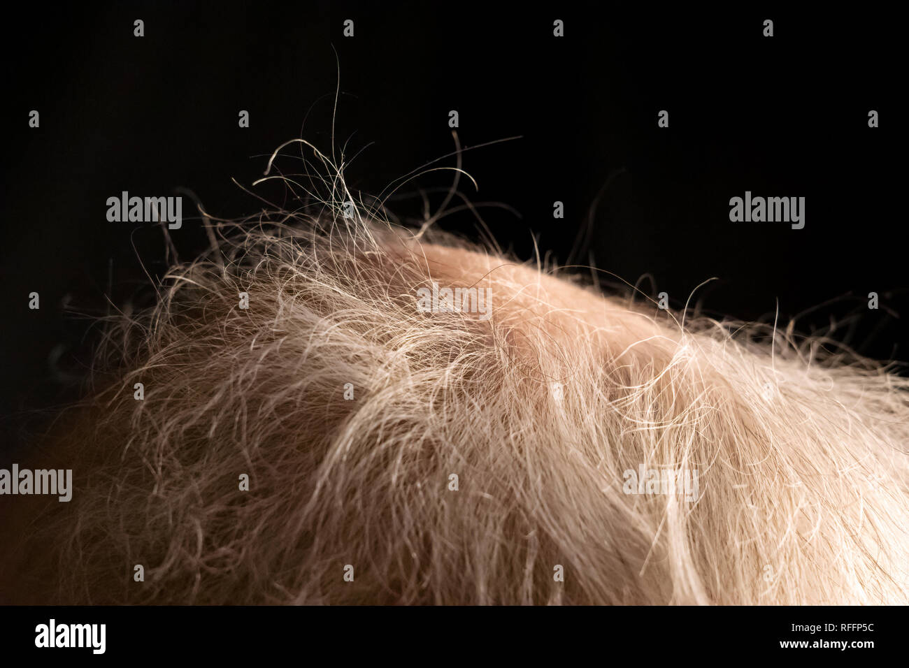 scalp of adult senior man with beginning baldness Stock Photo