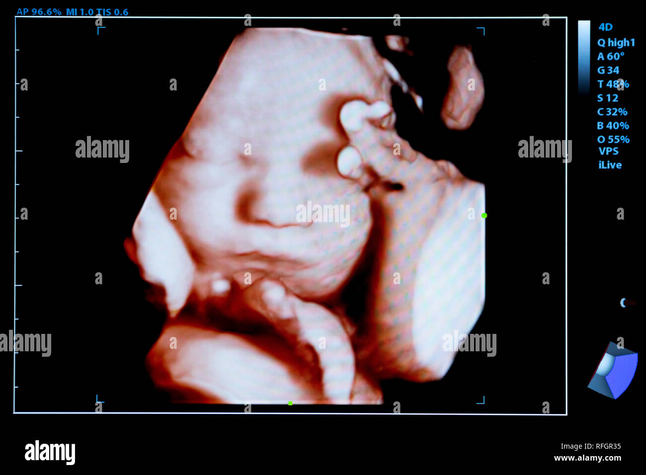 https://c8.alamy.com/comp/RFGR35/colourful-image-of-modern-ultrasound-monitor-ultrasonography-machine-high-technology-medical-and-healthcare-equipment-ultrasound-imaging-or-sonogra-RFGR35.jpg