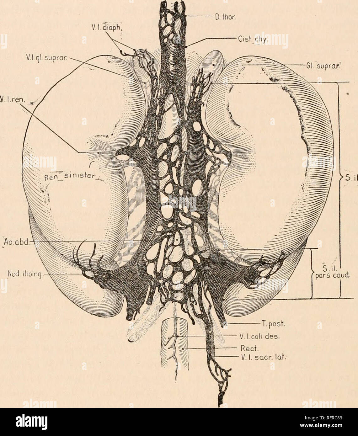 . Carnegie Institution of Washington publication. 28 FATE OF PRIMARY LYMPH-SACS IN ABDOMINAL REGION OF PIG, ETC. With the growth of the embryo these sacs come to lie entirely lateral to the aorta in approximation to and above the retroperitoneal sac, which likewise has become situated lateral to the aorta. These three sacs are connected by small channels which show in figures 2 and 4, and when they are transformed into lymph-glands the result is a rather confusing V I 3iaph D thor. V.l.ql. suprar. 61 suprar.' V.l.coli des. Rect. V. I. sacr. lot. Ao.abd Nod iliomqA FIG. 4.—Dorsal view of specim Stock Photo