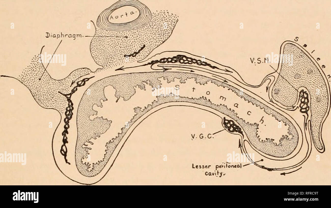 . Carnegie Institution of Washington publication. LYMPHATICS IN THE STOMACH OF THE EMBRYO PIG. 7 traverses the gastro-splenic ligament to the center of the greater curvature of the stomach where it ramifies to right and left (fig. 4). These lymphatics then anasto- mose, over both the anterior and the posterior walls, with those from the lesser curvature, where connections are formed with the lymphatics of the esophagus and duodenum (cf. figures 4 and 5, plate 1). After this brief description of the general pathways along which lymphatic invasion of the stomach takes place, the characteristics  Stock Photo
