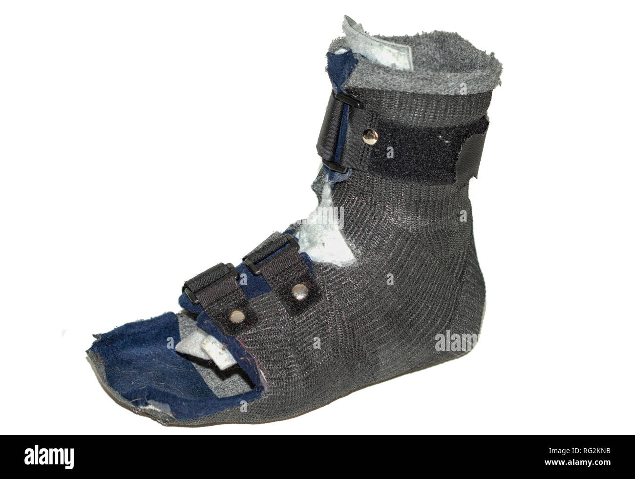 Protective inexpensive foot casting bandage  made of synthetic cast for walking Stock Photo