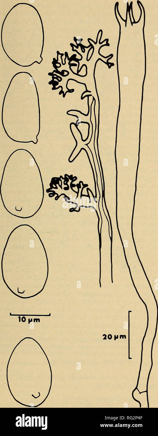 . The Canadian field-naturalist. 1982 GiNNS: Wood-inhabiting Fungus, Aleurodiscus 133. Figure 2. A leurodiscus dendroideus. Five basidiospores, the terminal segment of a sparsely branched acanthophy- sum and a basidium. From holotype. Habitat The basidiomes were emerging either between or from somewhat under bark scales on the sides and lower surface of a 7 mm diameter branch of Picea glauca. It is not known whether the branch was on the ground, on a dead tree or a dead branch on a live tree. The latter is a preferred habitat for some species (e.g., Aleurodiscus amorphus). Aleurodiscus grantii Stock Photo