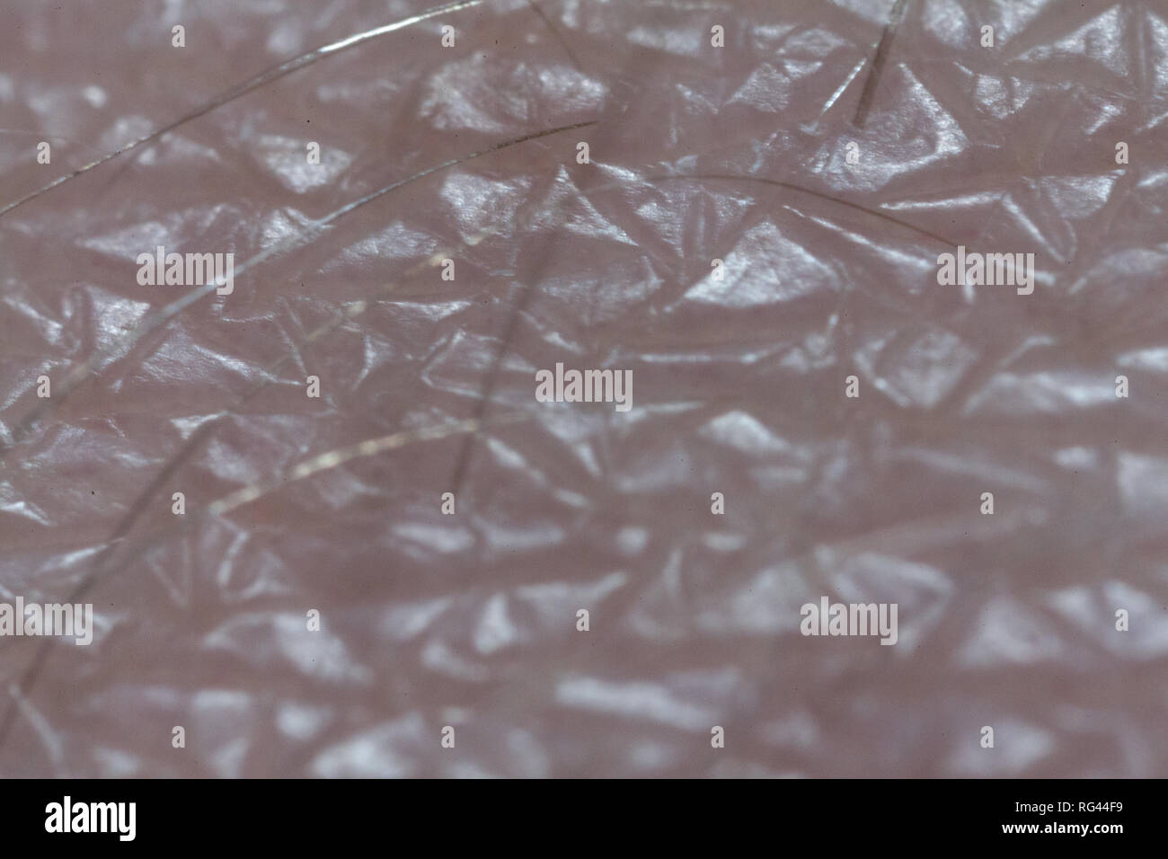 Human Skin with Hair, Macro 5x Stock Photo - Alamy