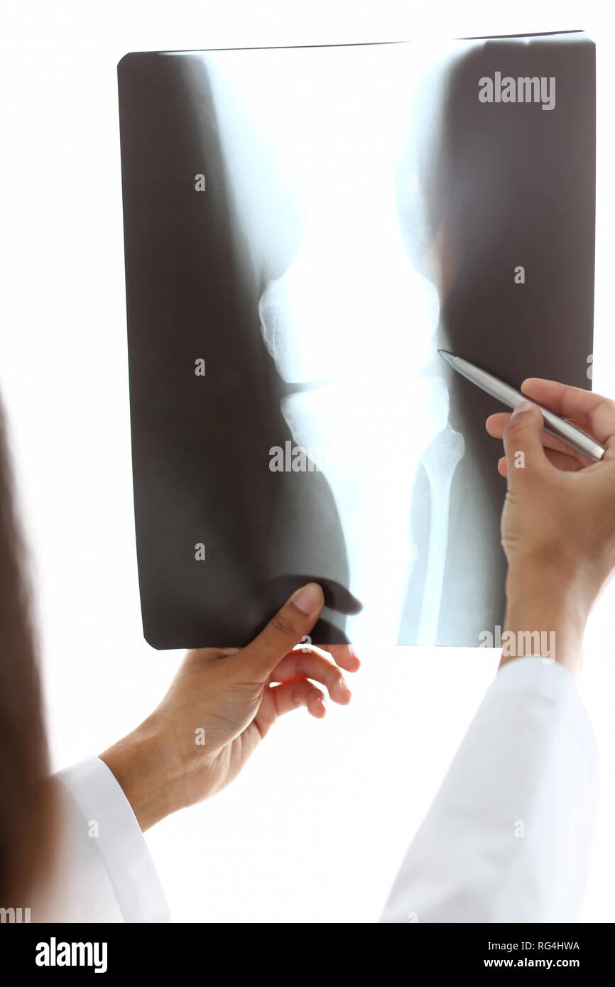 Black female doctor x ray hi-res stock photography and images - Alamy