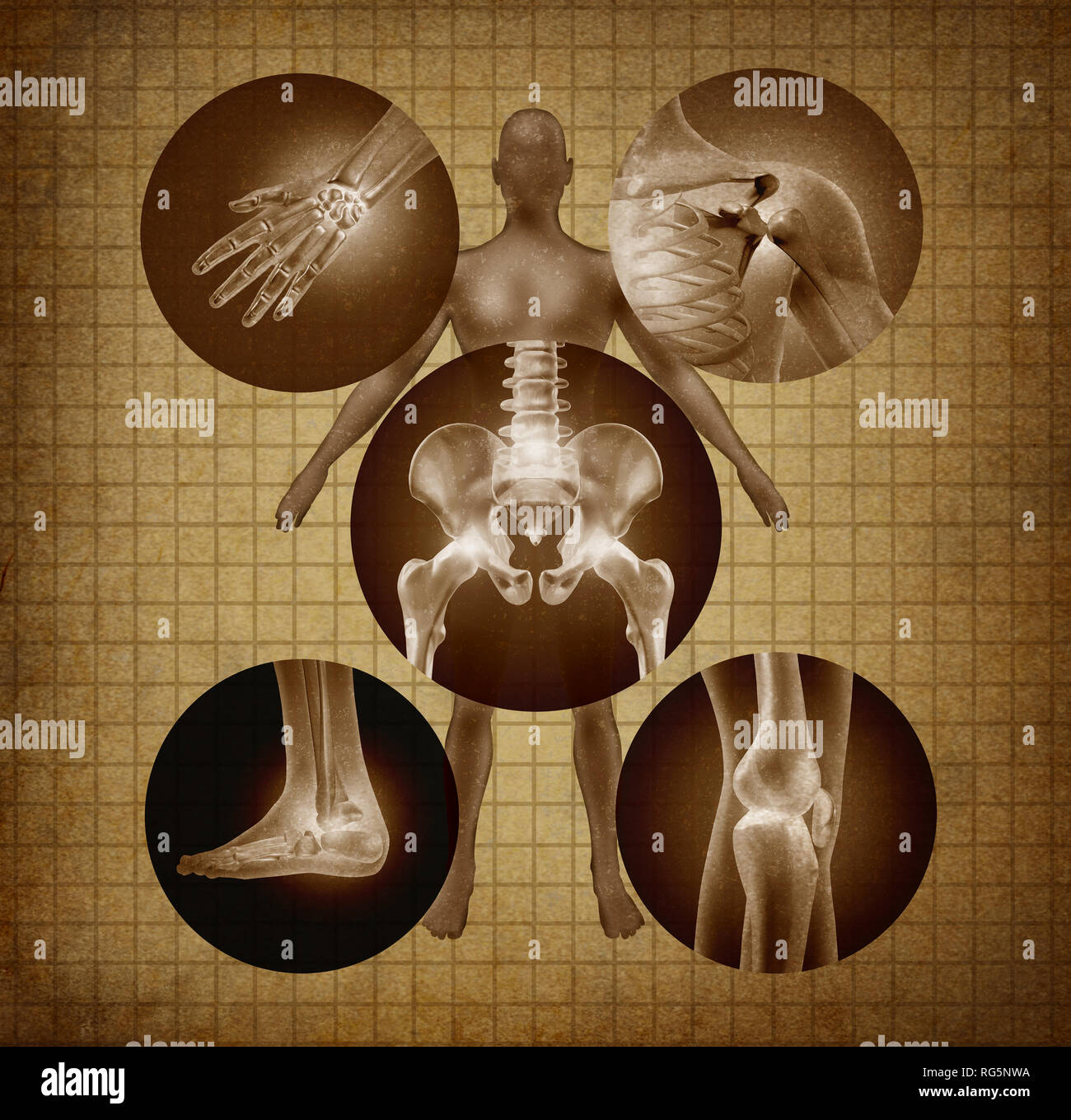 Human painful joints and anatomy concept as body pain and injury or arthritis illness symbol for health care and medical symptoms due to aging. Stock Photo