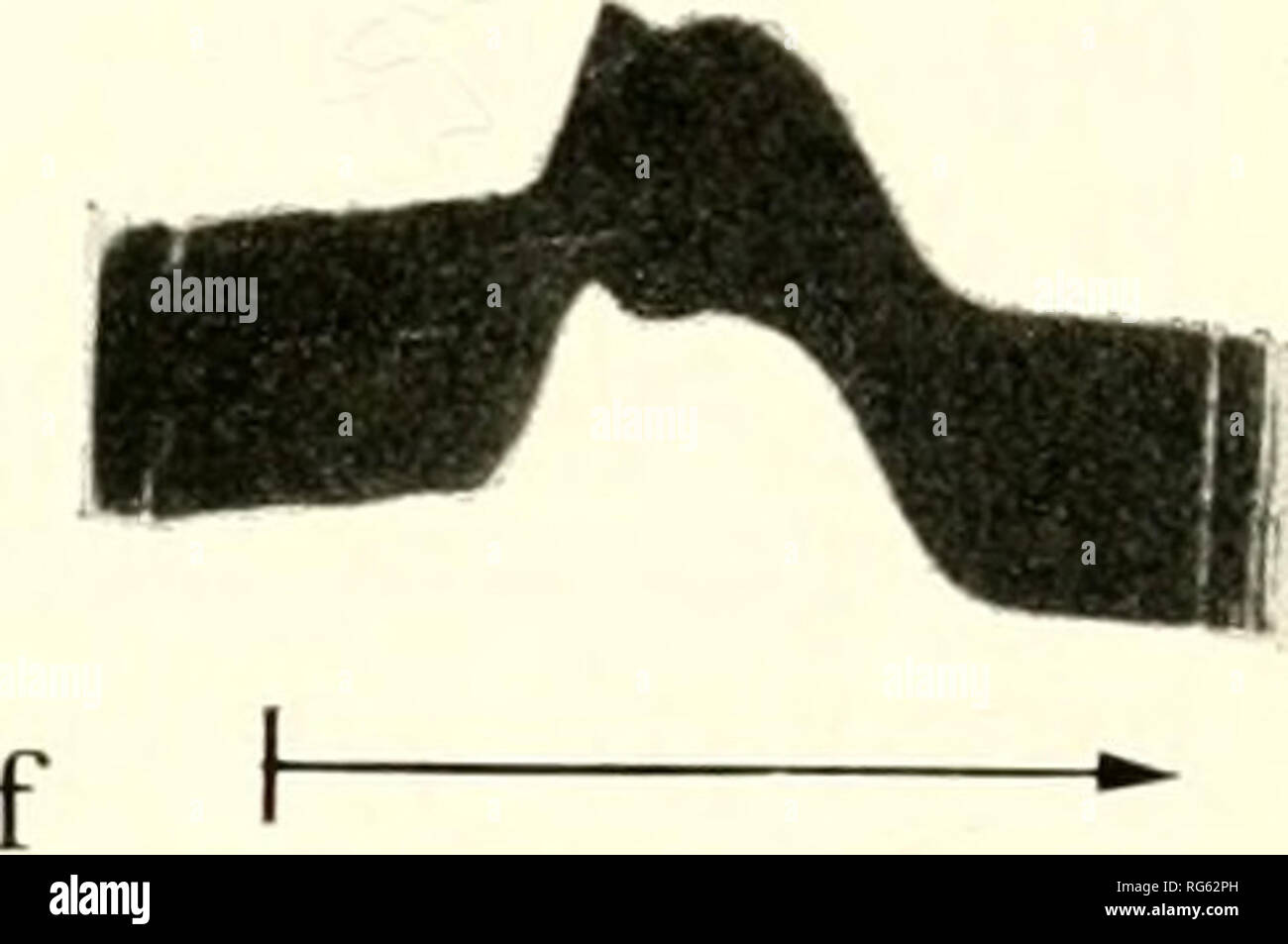 . Calcified tissues; proceedings. Bone; Collagen; Calcification. Fig. 3. Free zone electrophoresis patterns at various Fig. 4. Identical conditions as Fig. 3. d) pH 5.52 at pH's at constant ionic strength potassium phosphate 150 min., sodium acetate buffer, e) pH 5.14 at 150 min., bulTer of 0.1, 2,5^, protein concentration is 1.4°/o. a) sodium acetate buffer, f) pH 3.61 at 120 min., sodium pH 7.51 at 105 min., b) pH 6.64 at 150 min., c) pH formate buffer. A — ascending patterns, D — descend- 6.04 at 160 min. A — ascending patterns, D — descend- ing patterns. — Arrows point in direction of move Stock Photo