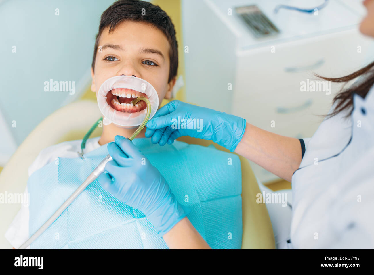 Little boy in a dental caries removal procedure, pediatric