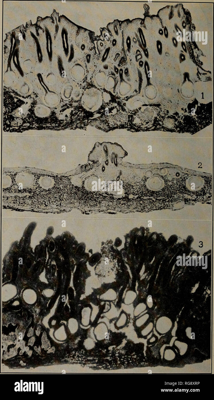 . [Bulletins on forest pathology : from Bulletin U.S.D.A., Washington, D.C., 1913-1925]. Trees; Plant diseases. Bui. 380, U. S. Dept. of Agriculture. Plate XVI.. ENDOTHIA PARASITICA AND E. FLUENS. VERTICAL SECTIONS OF STROMATA. X 20. Fig. 1.—E. parasitica. Showing Perithecia Arranged in Several Irregular Layers. Fig. 2.—E. parasitica, Showing Perithecia Arranged in a Single Layer. Fig. 3.—E. fluens, from Italy, Showing Perithecia Arranged in Several Layers.. Please note that these images are extracted from scanned page images that may have been digitally enhanced for readability - coloration a Stock Photo