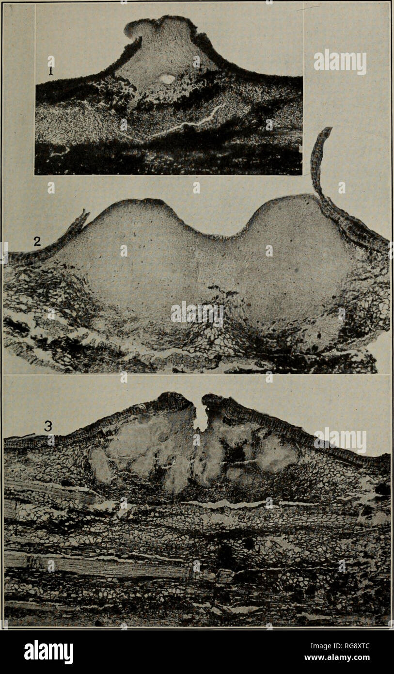 . [Bulletins on forest pathology : from Bulletin U.S.D.A., Washington, D.C., 1913-1925]. Trees; Plant diseases. Bui. 380, U. S. Dept. of Agriculture. Plate XV.. ENDOTHIA PARASITICA. VERTICAL SECTIONS OF STROMATA. X 49. Fig. 1 .—Showing a Young, Simple Pycnidial Cavity at the Base. Fig. 2.—In Which Neither Pycnidia Nor Perithecia Have Begun to Develop. Fig. 3.—With Irregular Chambered Pycnidia. All the above are about the same age—four months after inoculation.. Please note that these images are extracted from scanned page images that may have been digitally enhanced for readability - coloratio Stock Photo