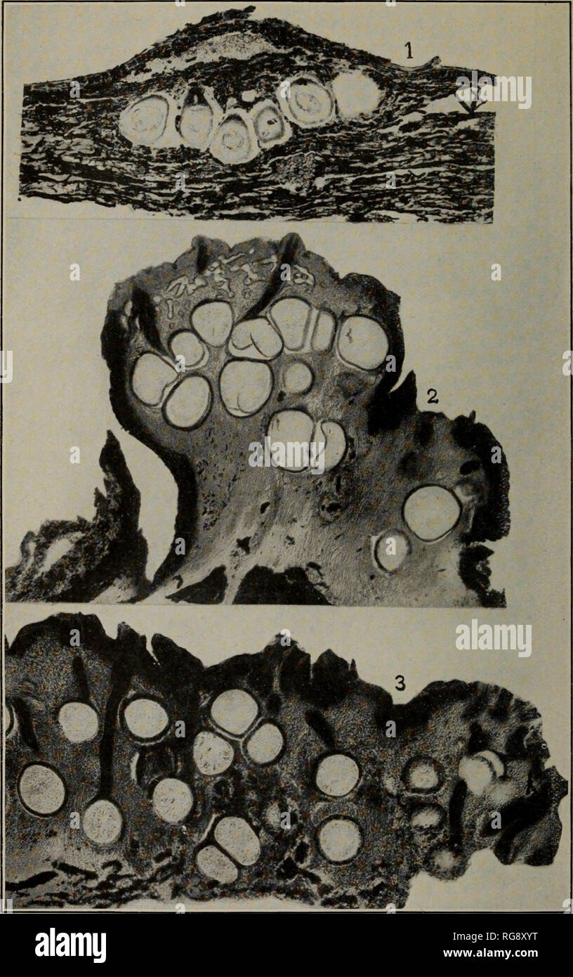 . [Bulletins on forest pathology : from Bulletin U.S.D.A., Washington, D.C., 1913-1925]. Trees; Plant diseases. Bui. 380, U. S. Dept. of Agriculture. Plate X.. Fig. 1.—Endothia fluens. Vertical Section of a Stroma from Italy, Showing Young Perithecia in a Single Layer, x 49. Fig. 2.—Endothia gyrosa. Ver- tical Section of a Stroma on Beech, Showing Mature Pycnidia with Mature Perithecia below Them, x 32. Fig. 3.—Endothia gyrosa. Vertical Section of a Portion of a Large Stroma, Showing Perithecia Irregularly Arranged in Several Layers.. Please note that these images are extracted from scanned pa Stock Photo