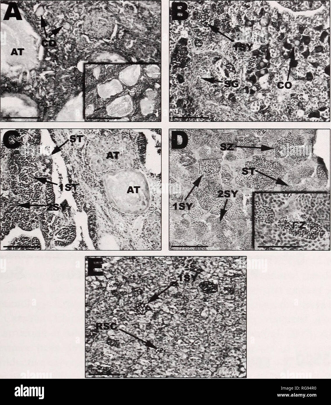 . Bulletin - Southern California Academy of Sciences. Science. CLASSIFICATION OF GONAD MACROSTRUCTURE IN CALIFORNIA SHEEPHEAD 23. Fig. 3. Representative photographs of male California Sheephead testicular development. Bars in the lower left corner of each photo represent 100 micrometers. Inset bars in (A) and (D) represent 400 micrometers and 50 micrometers, respectively. (A) During the earliest noted transition class very high levels of atretic follicles are noted, few early stage oocytes, and massive tissue reorganization. (B) As the transition progresses, spermatogonia and primary spermatoc Stock Photo