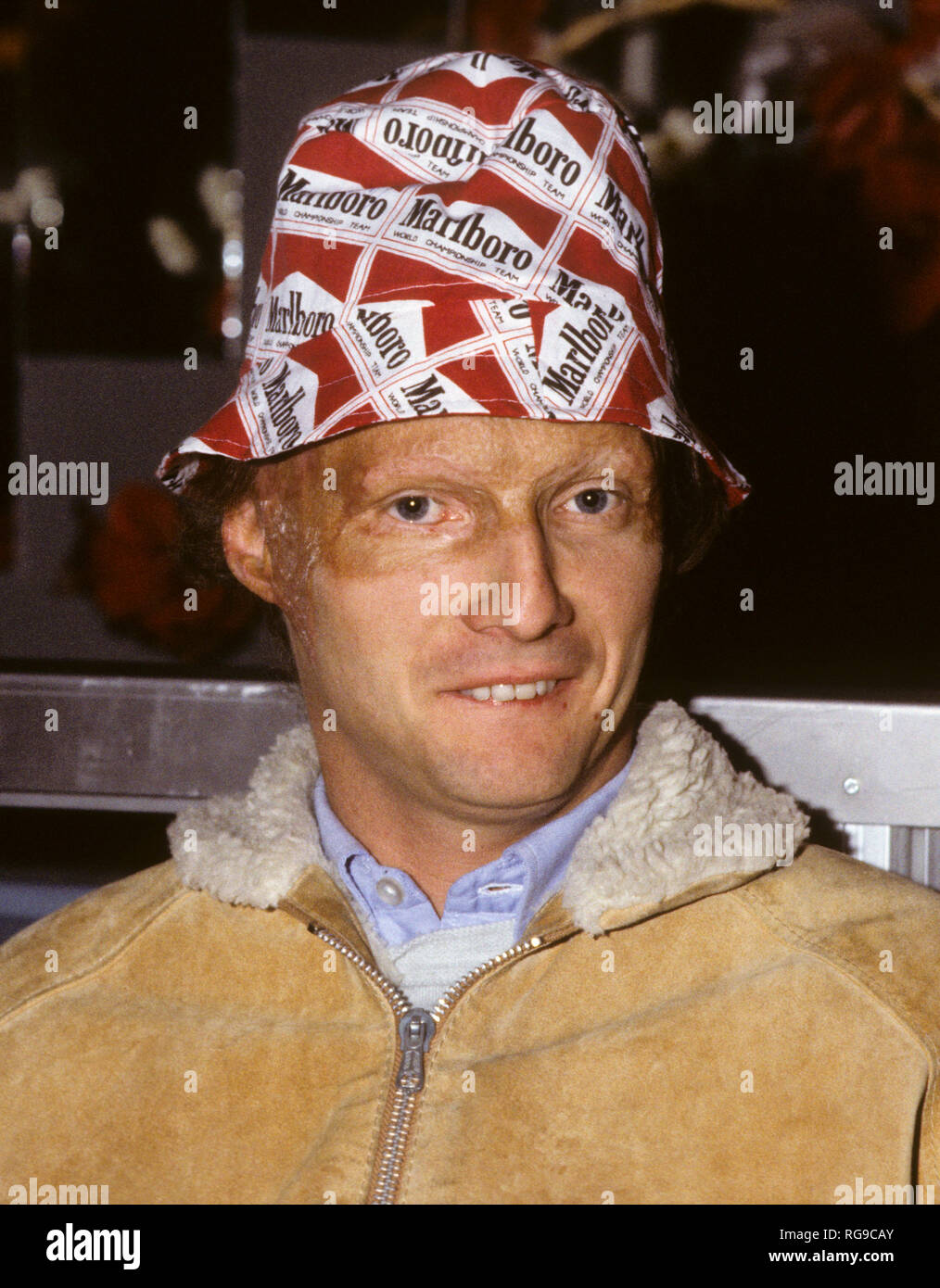 NIKI LAUDA Austrian formula one driver with a face damaged after accident  Stock Photo - Alamy