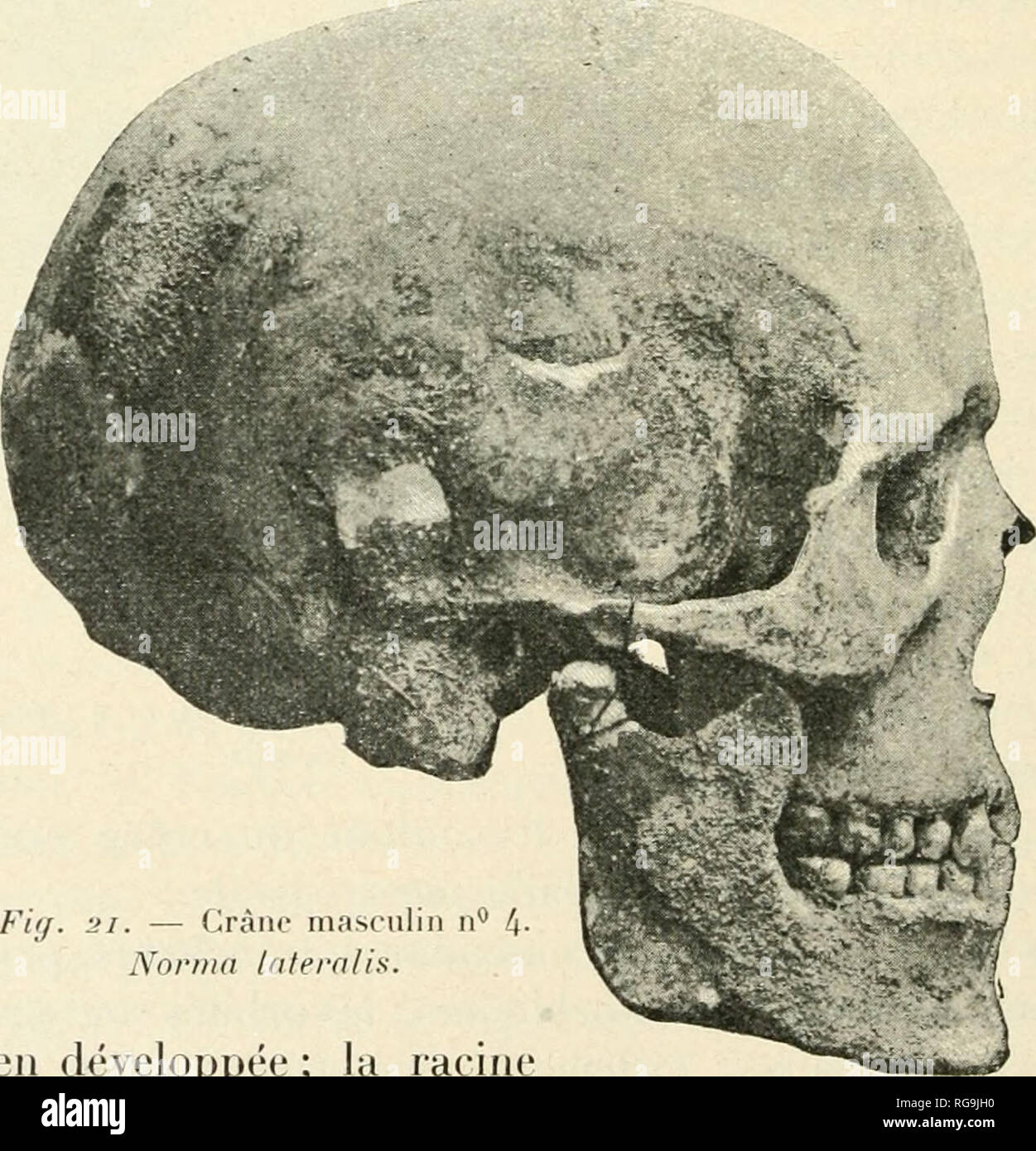 . Bulletin de la Socit vaudoise des sciences naturelles. Natural history; Natural history -- Switzerland. i36 D'&quot; ALEXANDRE SGHENK aiyu. L'ouverture nasale, haute et Ã©troite, iiKlifjue un nez leptorhinien (indice 4-^,09). La face, quoique haute, est cependant trÃ¨s Ã©iari^ie, Ã®^rÃ ce au fort dÃ©veloppement des os jug&quot;aux. L'arcade alvÃ©o- laire est rÃ©Ã§culiÃ¨rement dÃ©veloppÃ©e; sauf la deuxiÃ¨me inci- sive et la troisiÃ¨me molaire droites et les deux incisives gauches, toutes les dents existent et sont en })arfait Ã©tat de conservation, l'usure est presque nulle. L'absence des de Stock Photo