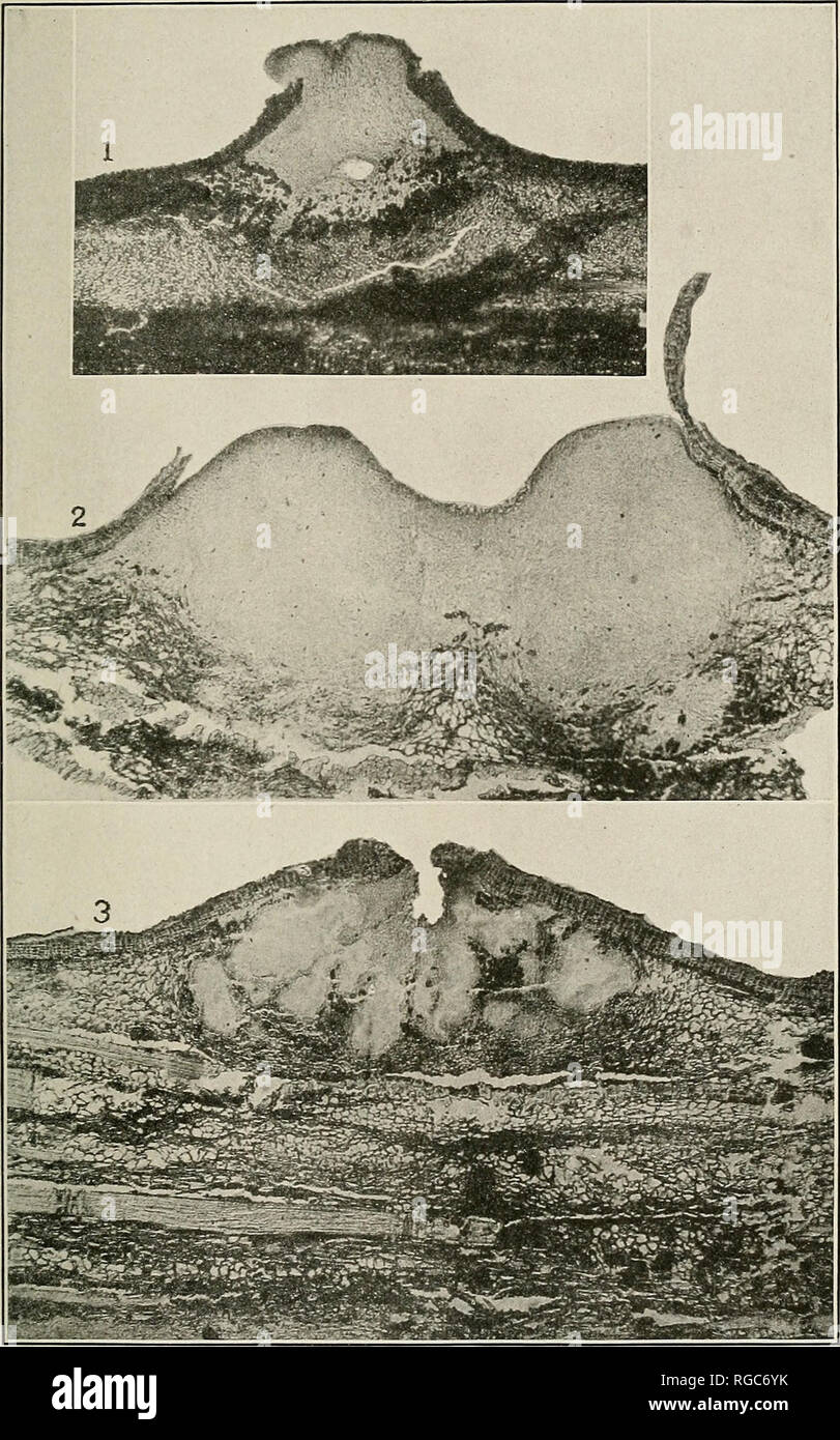 . Bulletin of the U.S. Department of Agriculture. Agriculture; Agriculture. Bui. 380, U. S. Dept. of Agriculture. Plate XV.. ENDOTHIA PARASITICA. VERTICAL SECTIONS OF STROMATA. X 49. Fig. 1 .—Showing a Young, Simple Pycnidial Cavity at the Base. Fig. 2.—In Which Neither Pycnidia Nor Perithecia Have Begun to Develop. Fig. 3.—With Irregular Chambered Pycnidia. All the above are about the same age—four months after hioculation.. Please note that these images are extracted from scanned page images that may have been digitally enhanced for readability - coloration and appearance of these illustrati Stock Photo