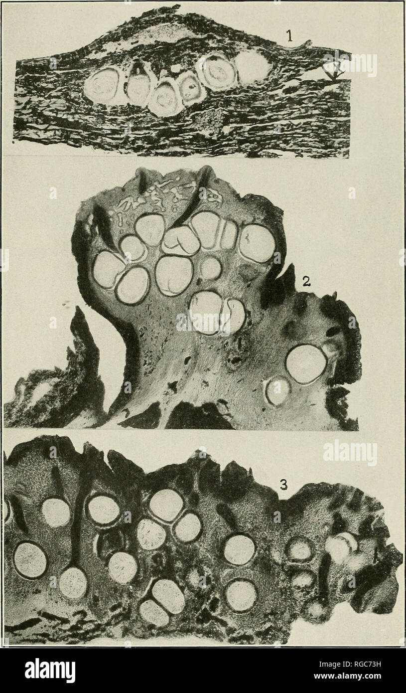 . Bulletin of the U.S. Department of Agriculture. Agriculture; Agriculture. Bui. 380, U. S. Dept. of Agriculture. Plate X.. Fig. 1.—Endothia fluens. Vertical Section of a Stroma from Italy, Showing Young Perithecia IN A Single Layer, x 49. Fig. 2.—Endothia qyrosa. Ver- tical Section of a Stroma on Beech, Showing Mature Pycnidia with Mature Perithecia below Them, x 32. Fig. 3.—Endothia gyrosa. Vertical Section OF A Portion of a Large Stroma, Showing Perithecia Irregularly Arranged IN Several Layers.. Please note that these images are extracted from scanned page images that may have been digital Stock Photo