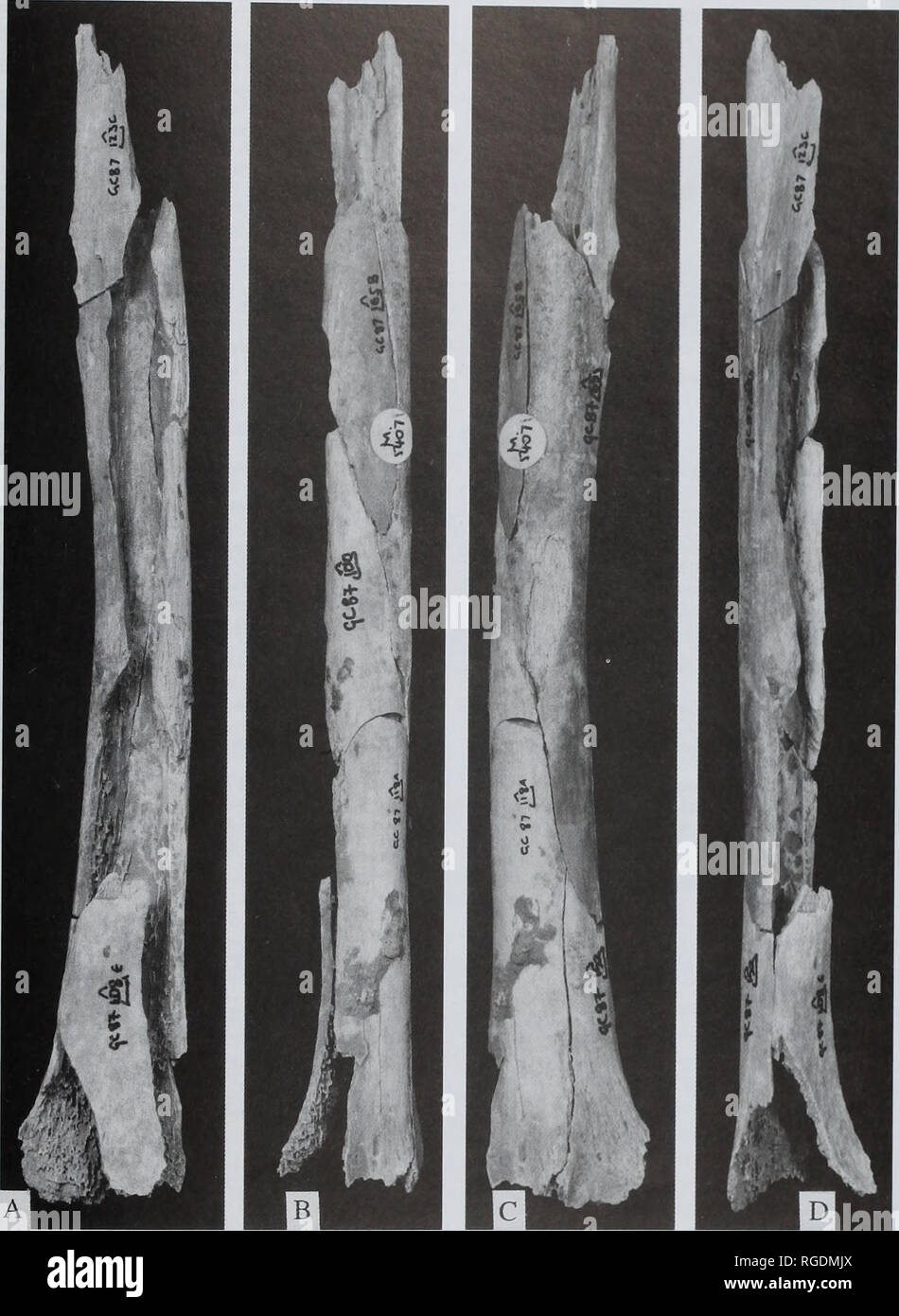 . Bulletin of the Natural Histort Museum. Geology series. CRESWELLIAN HUMAN UPPER LIMB REMAINS 23. Fig. 20 Left radius, M.54074 and M.54075, natural size. 20A, anterior: 20B, medial; 20C, posterior; 20D, lateral. fifteenth to sixteenth year in females, or in the eighteenth to nine- teenth year in males (Williams &amp; Warwick, 1980). M.54079(GC87 175 A) (Fig. 21) This specimen is a proximal phalanx lacking its proximal end, with a total length of 37.7mm (Fig. 21). The side is indeterminate. The proximal end is damaged and the epiphysis is missing. The damage is close to the epiphyseal line (th Stock Photo