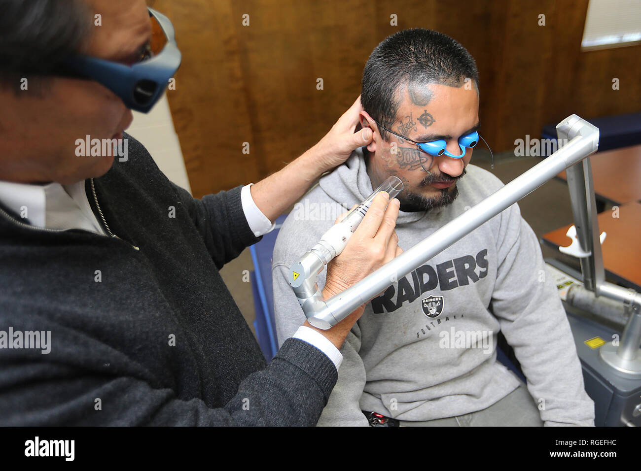 February 26, 2018 - Napa, CA, U.S. - Dr. William McClure, left of Napa Valley Plastic Surgery, removes a tattoo on the face of Jose De La Cruz at the Napa County Probation Department on Monday morning. (Credit Image: © Napa Valley Register via ZUMA Wire) Stock Photo
