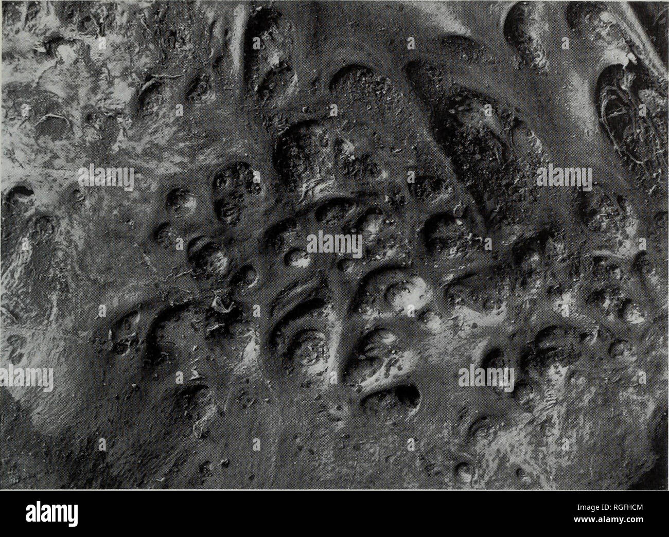 Frontoparietal hires stock photography and images Alamy