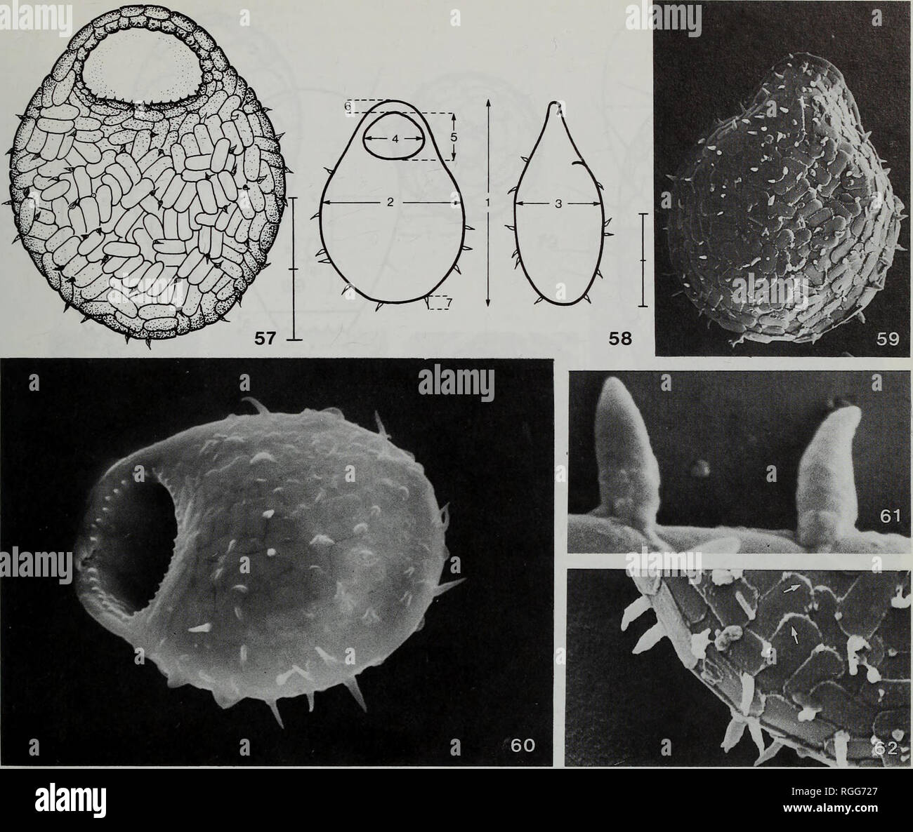 . Bulletin of the British Museum (Natural History) Zoology. TWELVE SOIL TESTATE AMOEBAE FROM AUSTRALIA, AFRICA, AND AUSTRIA 11. Figs 57-62 Corythion asperulum, light microscopic (Fig. 57) and SEM-aspects (Figs 59-62) and ideal individual (Fig. 58). 57 Ventral view. 58 Ventral and lateral view. 59,60 Dorsal and ventral view, x 1200, x 1700. 61 Spines, x 12300. 62 Detail of surface, x 3200. Note organic cement surrounding platelets (arrows). Scale bar divisions 10 urn. Shell measurements show rather high variability; only parameter (1) has a CV less than 10% (Table 10). The biometric data of Sch Stock Photo
