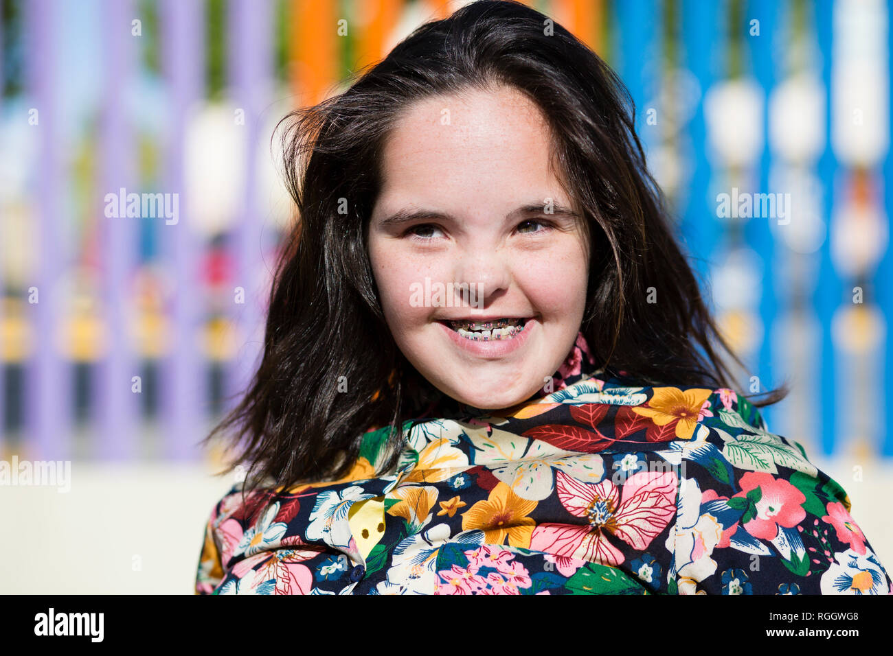 Teenager Girl With Down Syndrome Smiling Braces Stock Photo Alamy