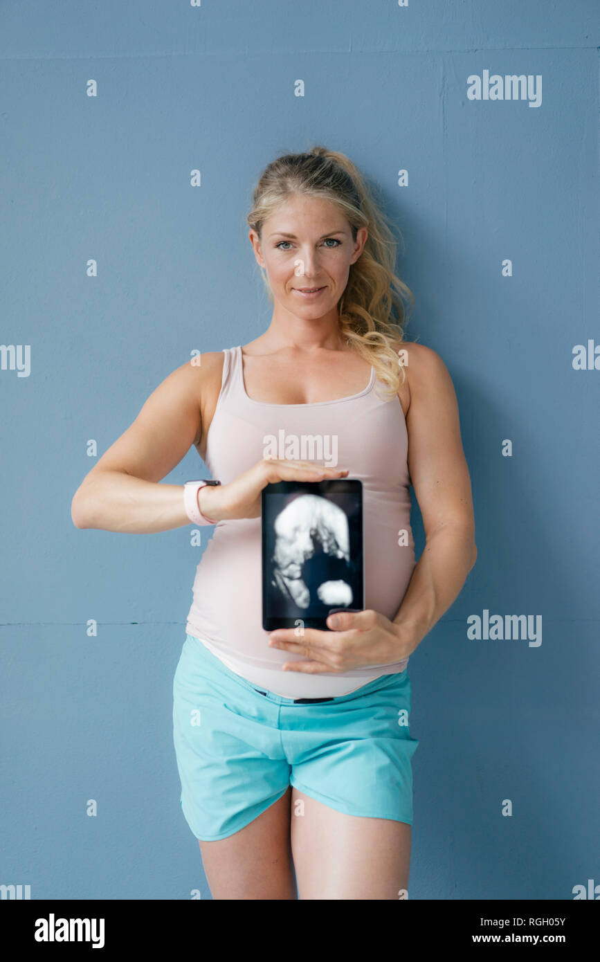 Ultrasound photographs hi-res stock photography and images - Alamy