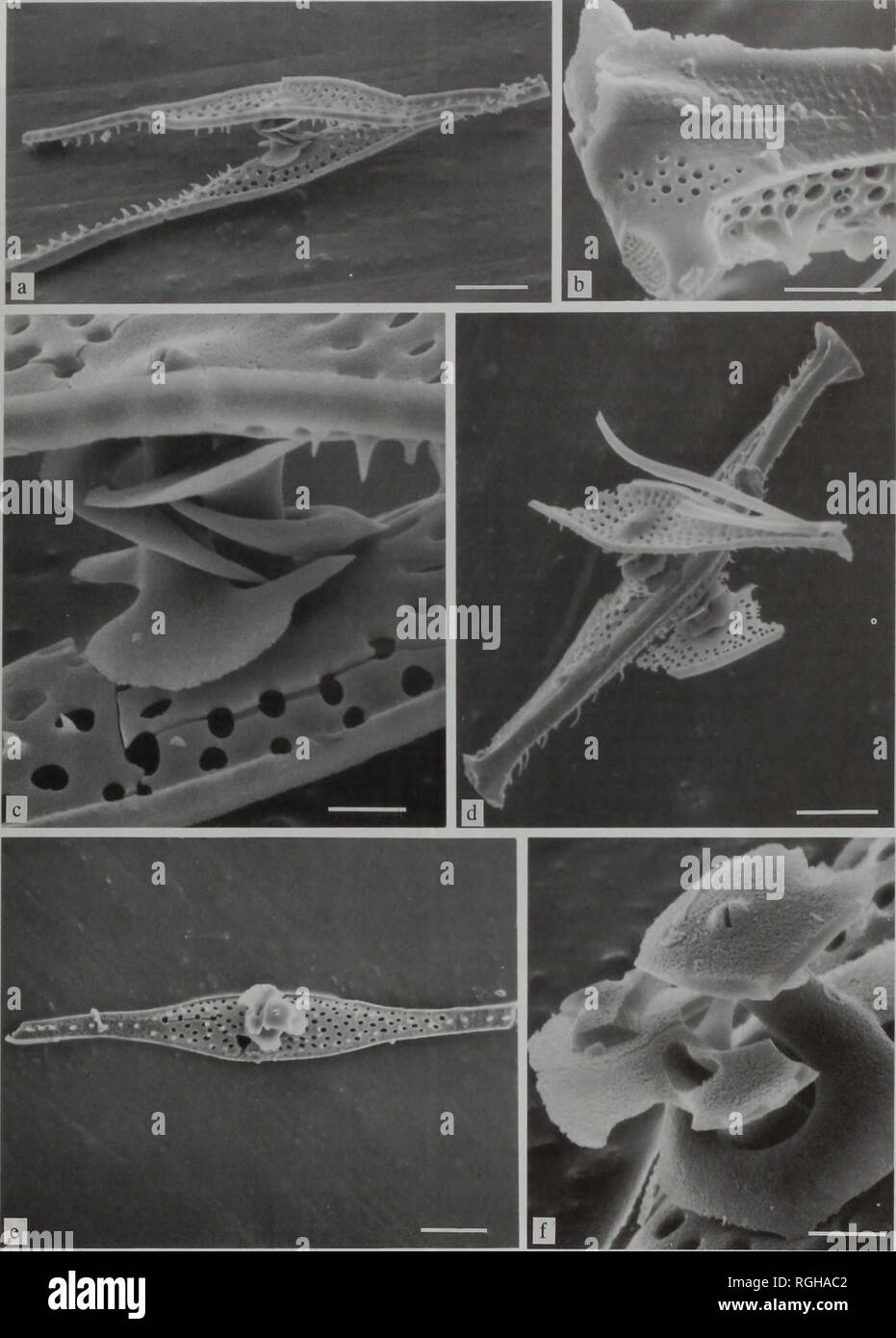 . Bulletin of the British Museum (Natural History), Botany. REVISION OF RUTILARIA GREVILLE (BACILLARIOPHYTA) 77. Plate VIII Rutilaria schenkii. Cantua Creek, Fresno County, California, U.S.A. (a): oblique view of sibling pair of valves (SEM 97982); (b): detail of (d), apex of frustule showing ocellus with porelli, poroids on mantle near apex and costa on proximal side of elevation (SEM 98051); (c): detail of (a) showing periplekta with flange and interlocking tips of longer arms (SEM 97981); (d): oblique view of frustule with parts of sibling valves attached (SEM 97978); (e): valve view of val Stock Photo
