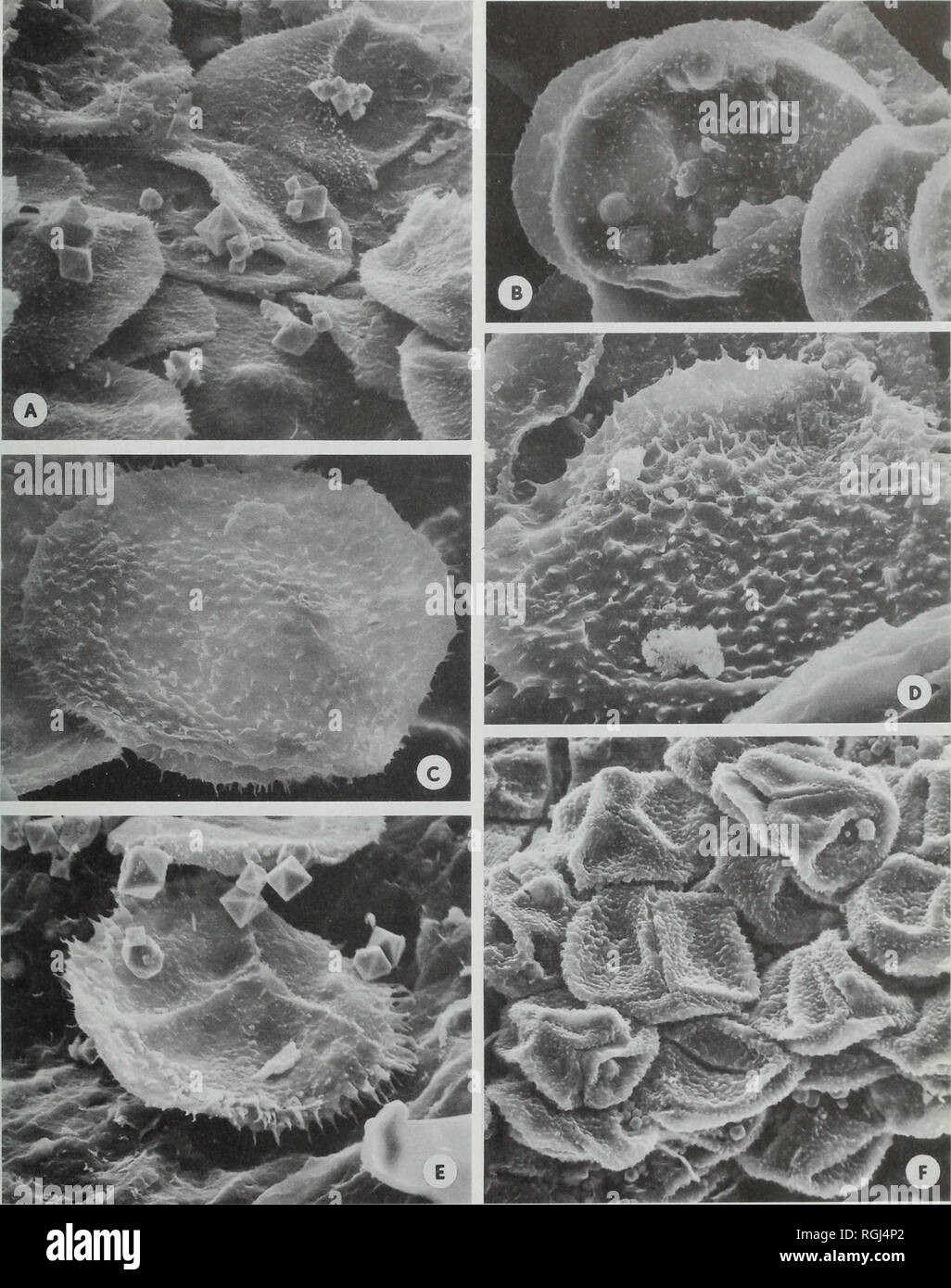 . Bulletin of the British Museum (Natural History), Geology. LECLERCQJA SPORES AND THE A. L1NDLARENSIS MORPHON 135. Fig. 8 Leclercqia complexa from Blenheim-Gilboa, scanning electron photomicrographs of in situ spores; (a-d) Type III; (e) Type IV; (f) Type V; all figures X 1,000, except (f) , X 500. (a) Part of a sporangial mass showing spores with small curvatural spinae and distal coni. 45A, tilt 90°. (b) Detail of spores from another sporangium showing sculpture of grana and coni, 181 A, tilt 0°. (c-d) Specimens showing larger distal sculpture borne by mural ridges or separated by lacunae,  Stock Photo