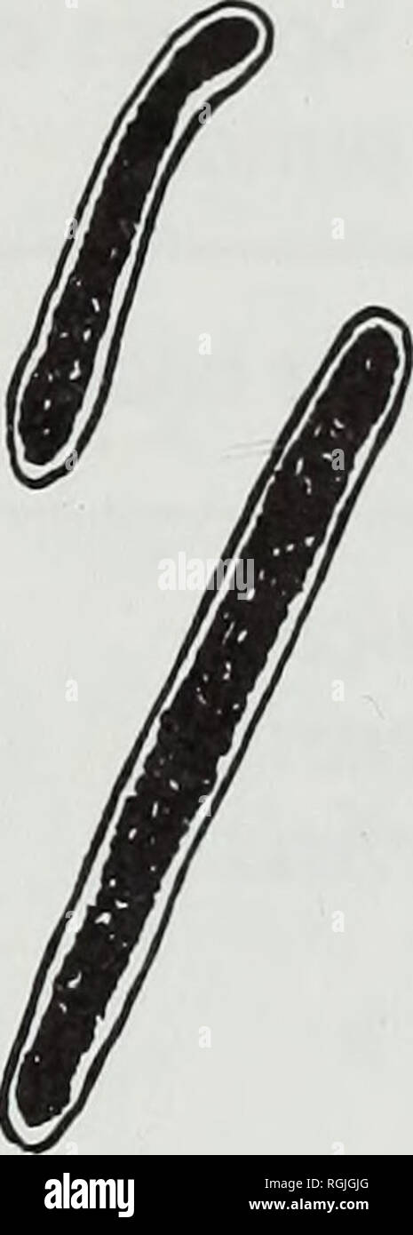 . Bulletin of the British Museum (Natural History). Botany; Botany. Fig. 1 Conidia in genus Parmelia s. lat. a: conidiophore with filiform conidia, P. euneta Stirton, 3K 16/122. b: bifusiform conidium, P. ducalis Jatta, E 30/12. c: sublageniform conidium, P. maclayana Miill. Arg., Ryvarden 9032. d: unciform conidium, P. subpraesignis Nyl., T 16/137. e: rod-shaped conidium, P. eciliata (Nyl.) Nyl., 4 May 1978, Dahls.n. Sublageniform conidia with one or two darker 'dots' (see below under rod-shaped conidia) have been seen in the subgenus Everniiformes. (c) Unciform conidia. We have chosen this t Stock Photo