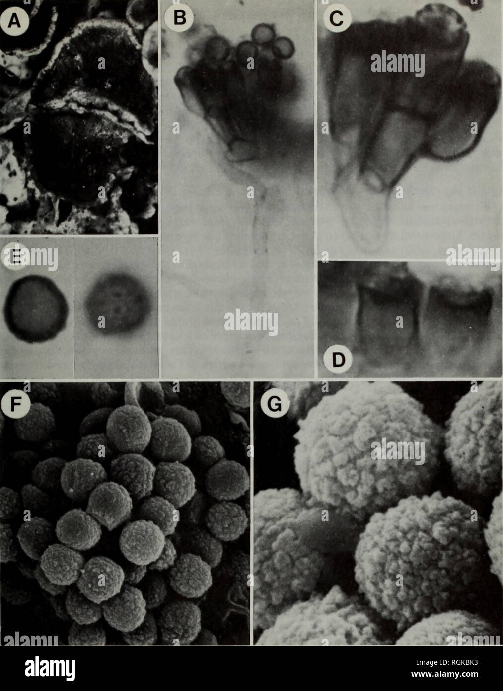 . Bulletin of the British Museum (Natural History) Botany. THE LICHENICOLOUS HYPHOMYCETES 267. Fig. 42 Xanthoriicola physciae. A, Infected discoloured apothecia of Xanthoria parietina ( x 16). B, Conidiophores immersed in the thecium of the host ( x 1400). C-D, Conidiogenous cells ( x3500). E, Conidium in optical section and surface view ( x3500). F, Group of conidia ( x 3000). G, Conidia showing verrucose ornamentation ( x 11 000). A, F-G IMI 171822; B-E IMI 164974. F-G Scanning electron micrographs.. Please note that these images are extracted from scanned page images that may have been digi Stock Photo