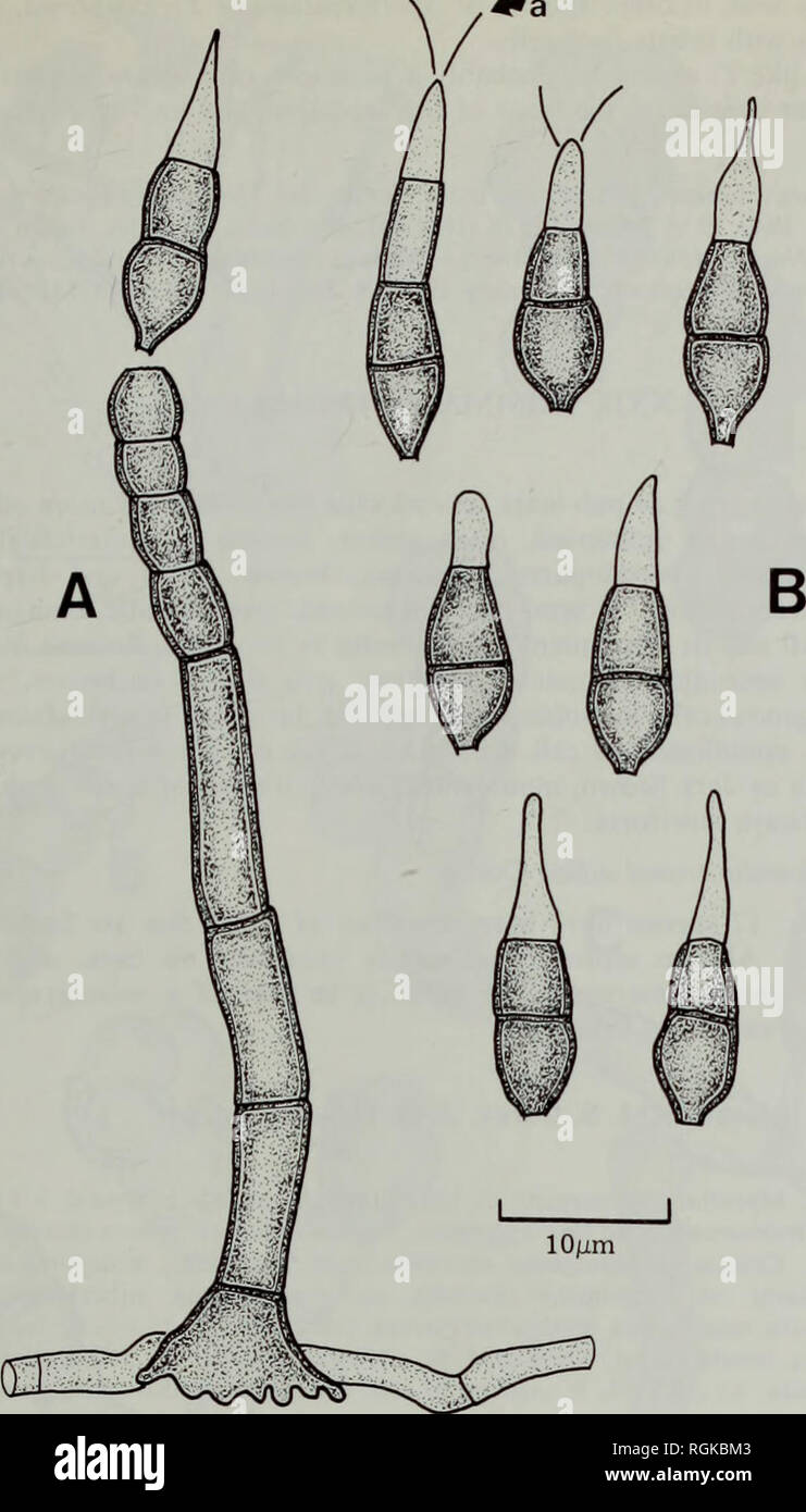 . Bulletin of the British Museum (Natural History) Botany. THE LICHENICOLOUS HYPHOMYCETES Ma 263. Fig. 40 Teratosperma lichenicola (IMI 2561 h—holotype). A, Conidiophore. B, Conidia (a, secondary conidia). characters in the taxon, now leave little doubt that it does represent a species distinct from T. anacardii. This species is unlike the taxa hitherto placed in Teratosperma in that it lacks appendages on the basal cell. The only alternative genus for it would be Sporidesmium Link ex Fr., which is essentially separated from Teratosperma on the basis of this character, but currently comprises Stock Photo