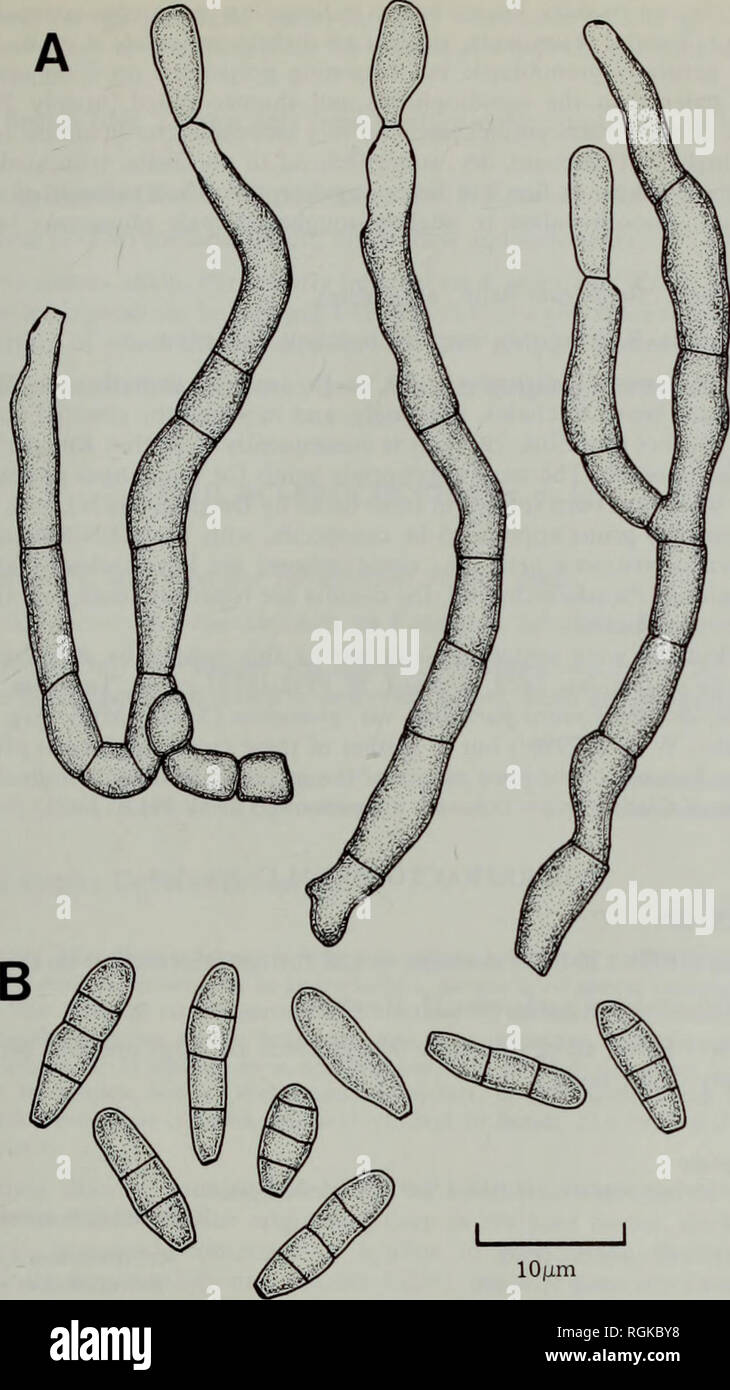 . Bulletin of the British Museum (Natural History) Botany. THE LICHENICOLOUS HYPHOMYCETES 247. Fig. 31 Pseudocercospora lichenum (W 1912/117—holotype). A, Conidiophores, some with young conidia attached to the conidiogenous cells. B, Conidia. flexuose, pale brown, relatively thin-walled, sometimes sparse, 1-5-3 urn wide. Stroma arising on the surface of the apothecial disc, very variable in extent, to 40 urn wide and 20 urn tall but structure often obscure due to mixture with the epithecial tissue and its granular pigments, composed of brown torulose hyphae with cells mainly 3-7 urn long. Coni Stock Photo