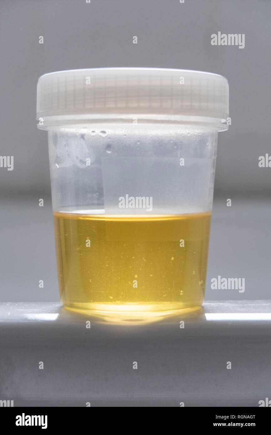 Urine Sample In A Cup Stock Photo Alamy specimen-collection-and-storage-urine-sample-cups-therapak