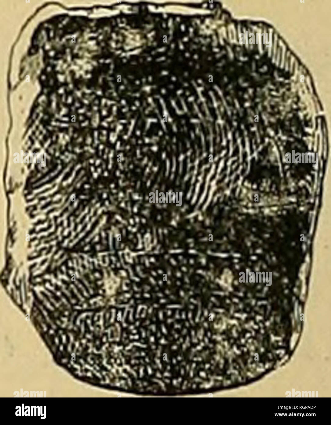 La plaque dentaire hires stock photography and images Alamy