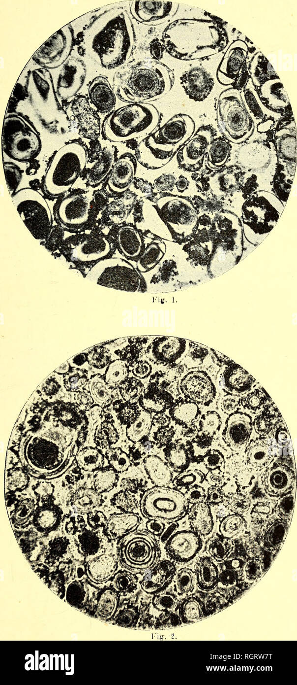 . Bulletin de la SociÃ©tÃ© belge de gÃ©ologie, de palÃ©ontologie et d'hydrologie. Geology; Paleontology. Bull. Soc. Belge GÃ©oL PalÃ©ont Hydrol. T. XII1 1899 Pl. Xi. Structure microscopique delÃ roch.e silicifiÃ©e oolitique, d'Ã¢ge jurassique (?) constituÃ©e par les cailloux mÃªlÃ©s aux quartzites blancs des hauts plateaux de la vallÃ©e de ]a Meuse. Kcliaiitillons des cm irons de iNniunr : plateau de Sl-II('ril)('i-t (ail. 21.'), soit Ã IdO mÃ¨tivs au dessus delÃ Meuse) RÃ©colte ; 2n Hl ]M-Iiantilli)us. ClicliÃ© ii&quot; 1.'. ; ////. / ; clicliÃ© u&quot; ; /ly. fl.. Please note that these imag Stock Photo