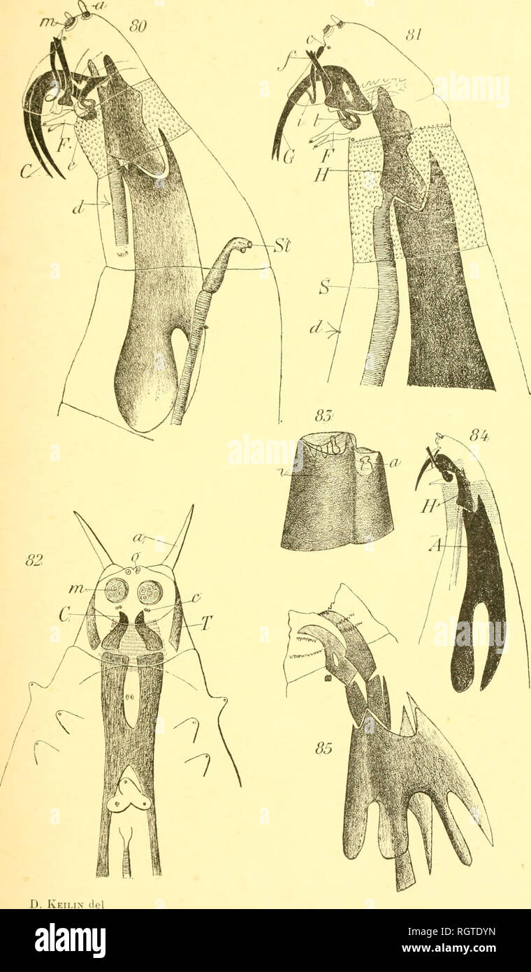 brassière post opératoire