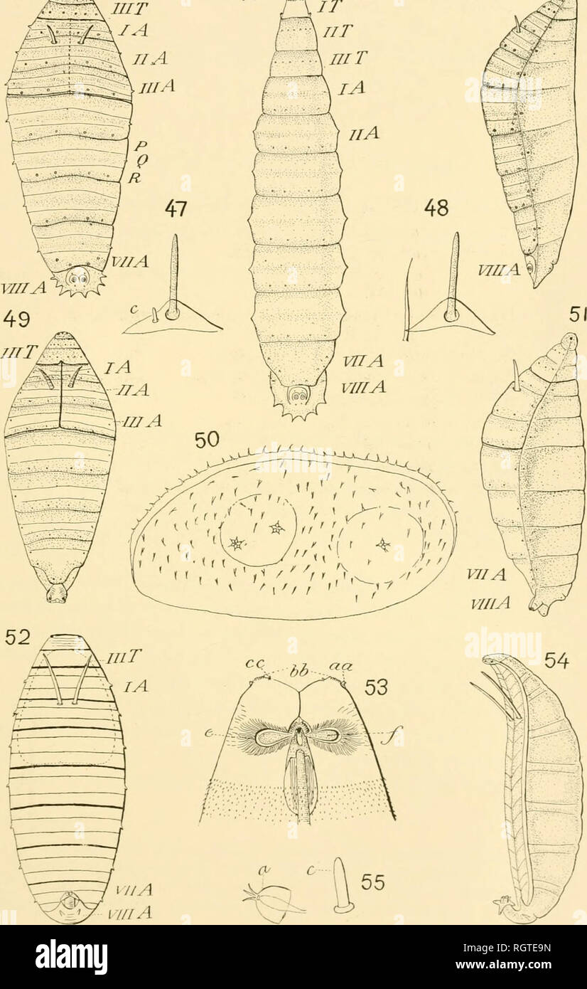 brassière post opératoire